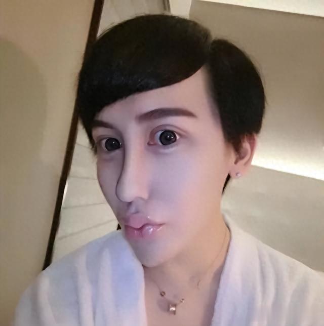 她被男友PUA、排泄难控穿纸尿裤！如今瘦成“皮包骨”，体重60斤