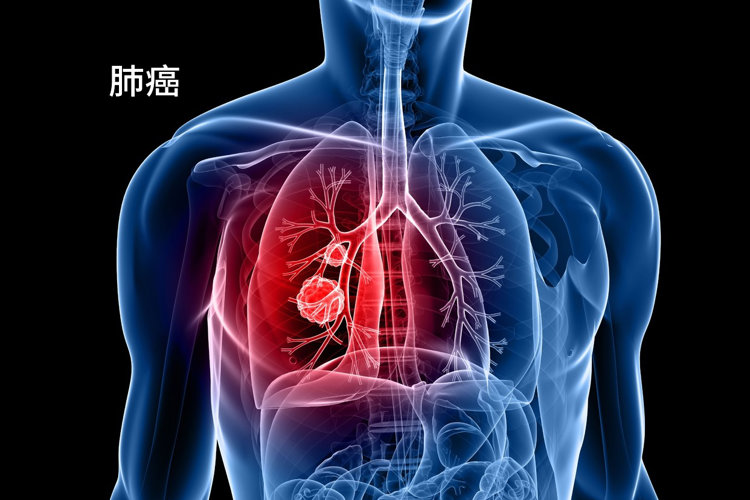 癌症来临前，会先经历“癌前病变”！这6种常见病，一定要警惕