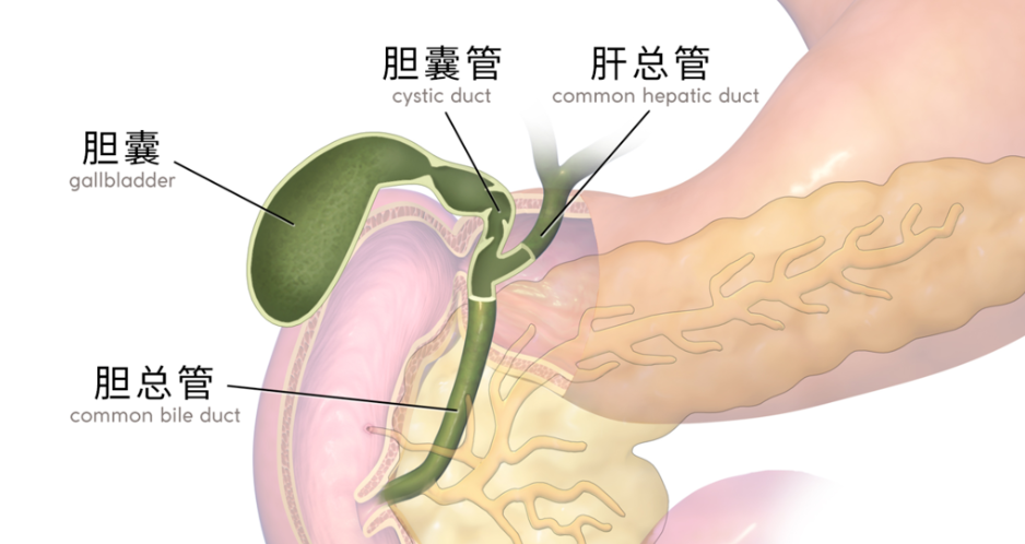 高热量美食引发胆结石?微创手术+及早治疗,轻松解除石化!