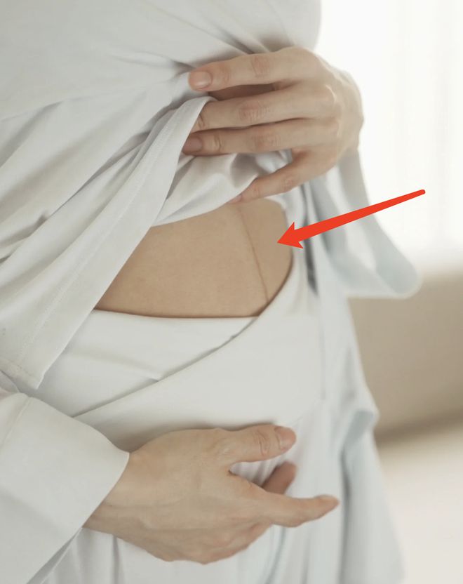 程晓玥|程晓玥产后暴露真实身材！胸部冒青筋颈纹变深腰间赘肉，网友: 太真实