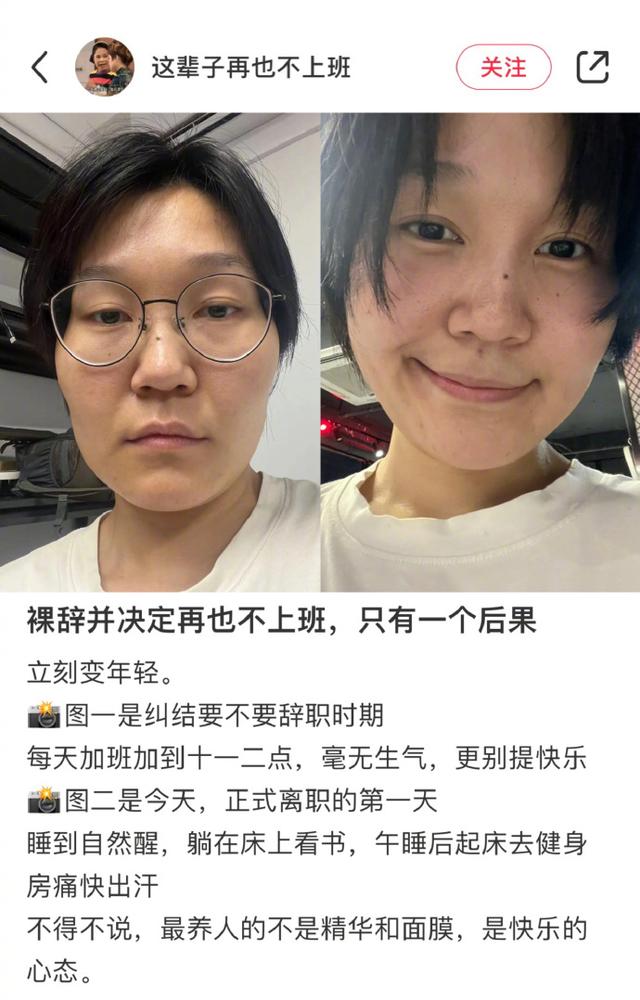 穿衣搭配 “离职，更适合中国宝宝的医美”