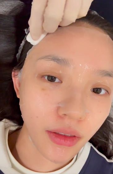 太真实!林允晒打水光针过程,画面高能,全程面不改色引争议