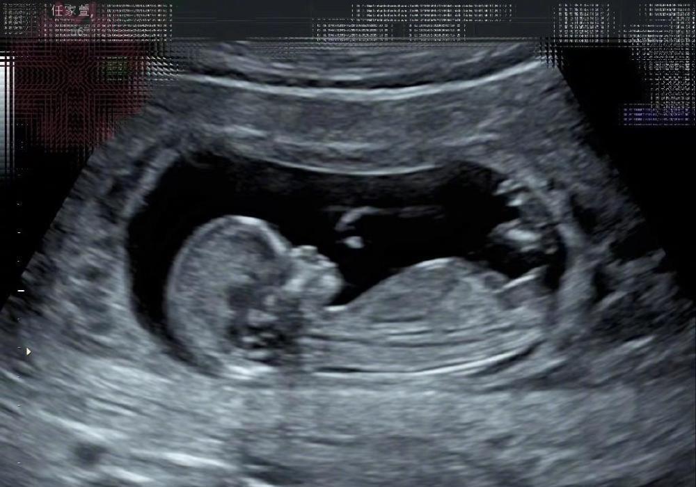 Selina|Selina前脚官宣怀孕，后脚被曝恋爱至今未领证！