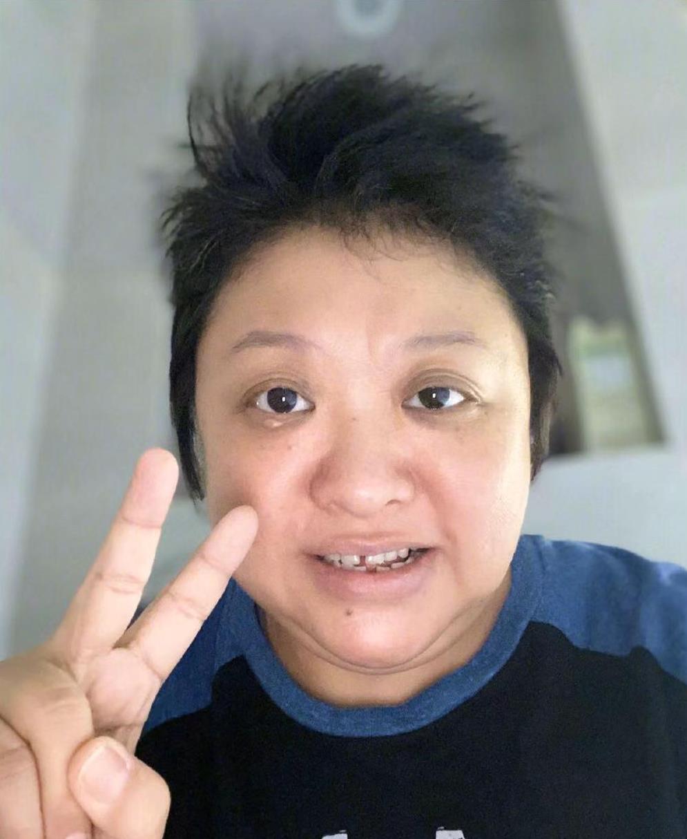 韩红终于现身！身材暴瘦，缺多颗牙齿状态萎靡，劳力士换称廉价手表