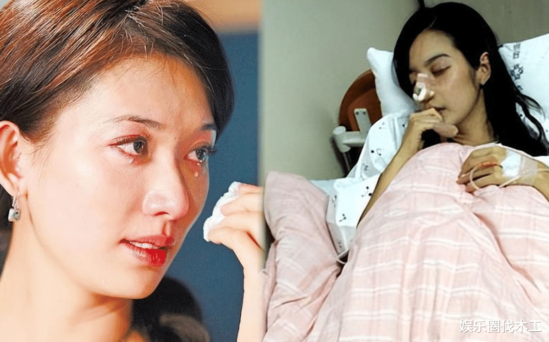 台媒曝林志玲再遭家暴,多张就医照片曝光,疑丈夫偷吃逼其下跪