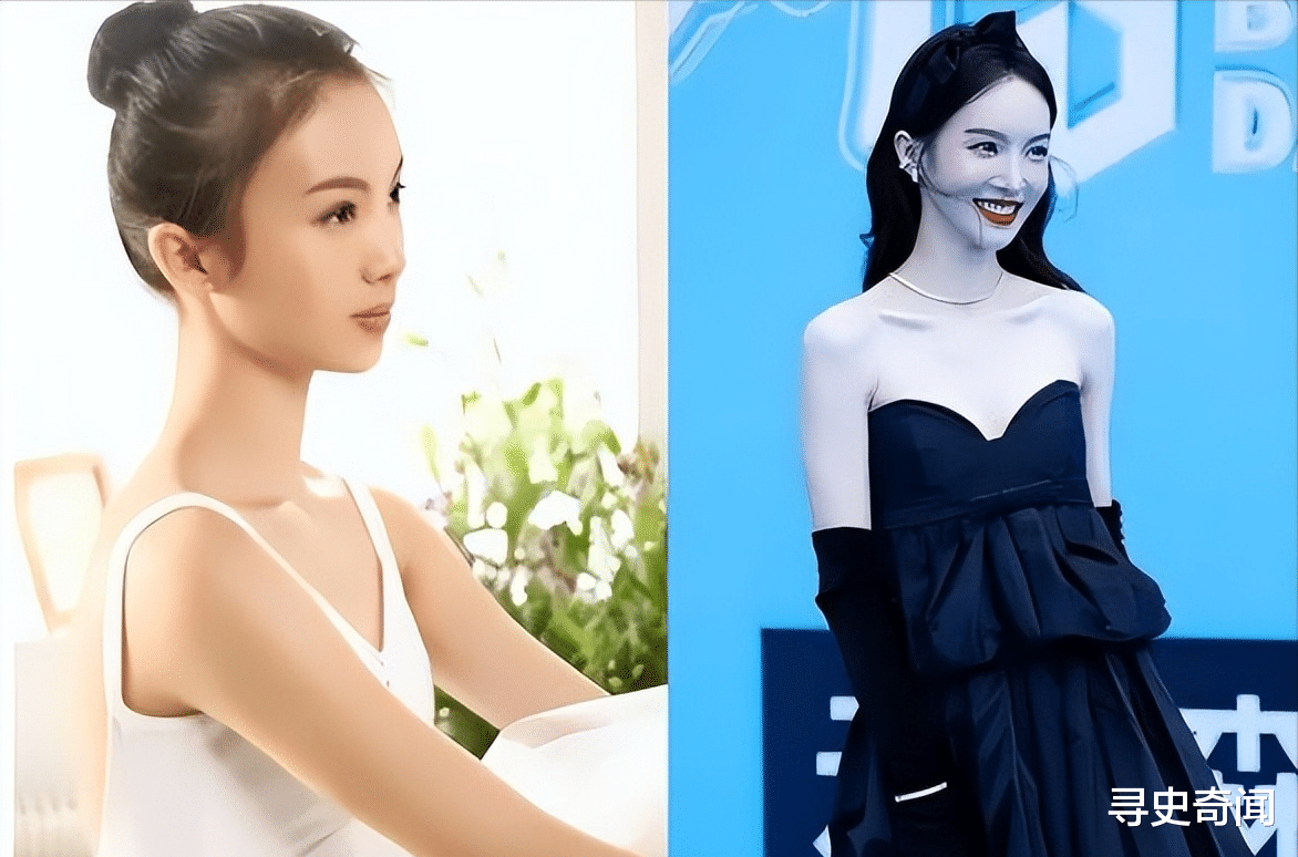 整容 整容成瘾、瘦成病态，娱乐圈里的“畸形”审美，什么时候到头？