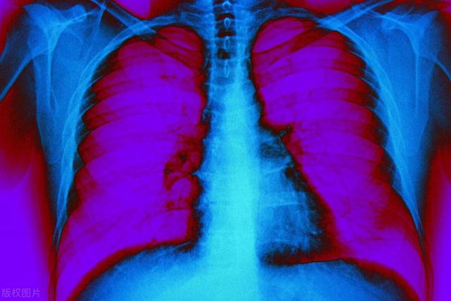 肺部有癌，睡眠先知？睡觉出现4种异常，要小心癌症来临