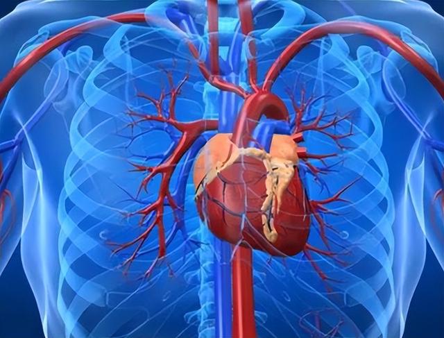 心梗猝死前，有1次救命机会，出现一个赶紧就医