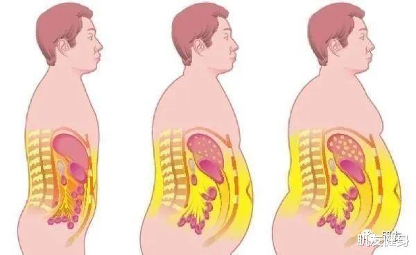 跑步|减掉内脏脂肪,跑步是不是最好的办法?
