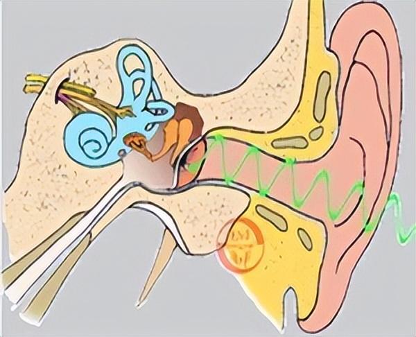46岁女子头晕，以为高血压引起，多次治疗均无效，医生：看错科了