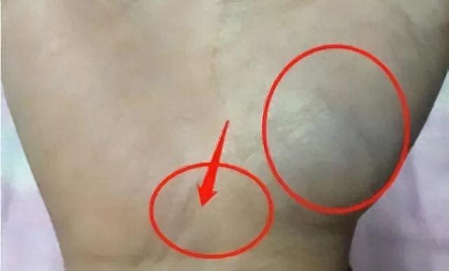 脾肺寒不寒，看这儿就知道！一旦发青，寒气或已深入