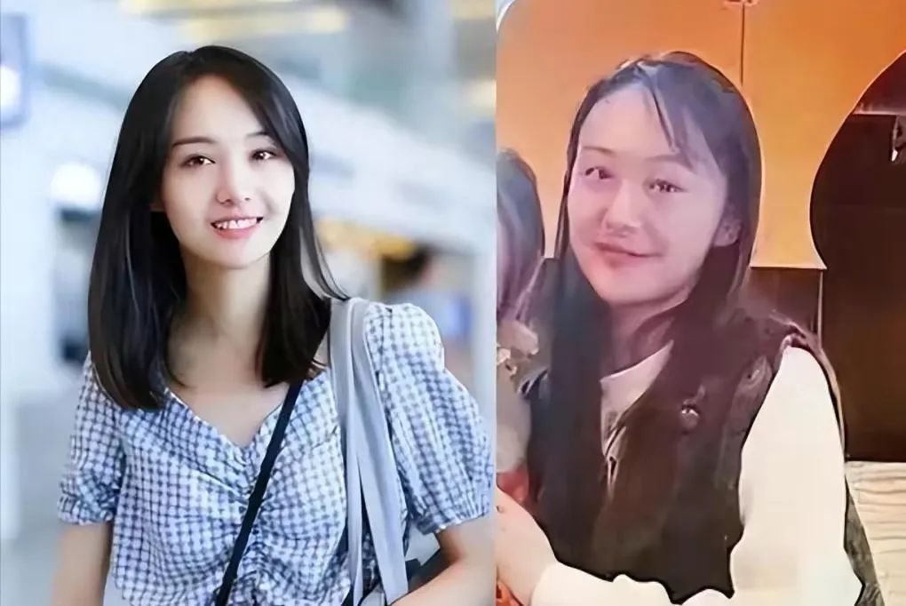 有一种整容叫郑爽退网,不当明星2年后,她开始进食变胖变秃?