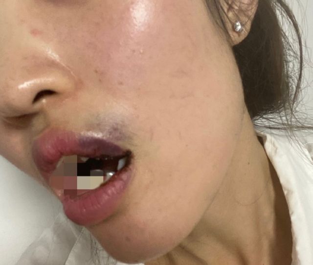 陈昱霖|懒理吴秀波再曝大瓜,陈昱霖疑官宣新恋情,无名指大钻戒超甜蜜!