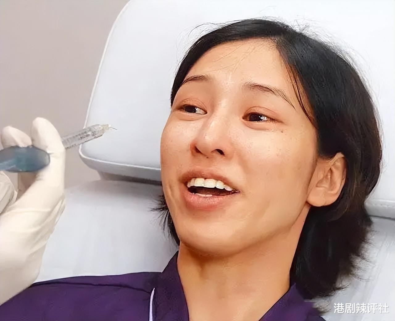 TVB女星退圈多年近照曝光,曾因整形失败惹非议,现转行做按摩师