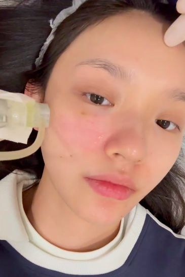 太真实!林允晒打水光针过程,画面高能,全程面不改色引争议