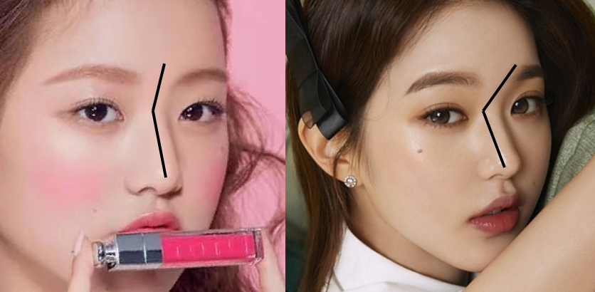 张雨绮的脸,怎么从千颂伊一夜间崩成蔡明了?