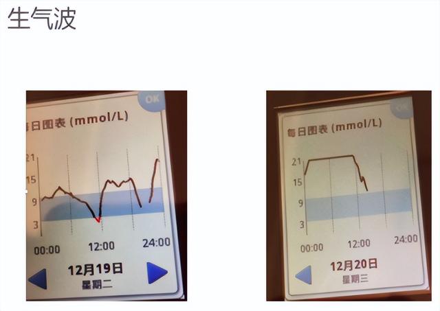 升血糖的三大因素排行，你知道几个？找准原因才能精准控血糖