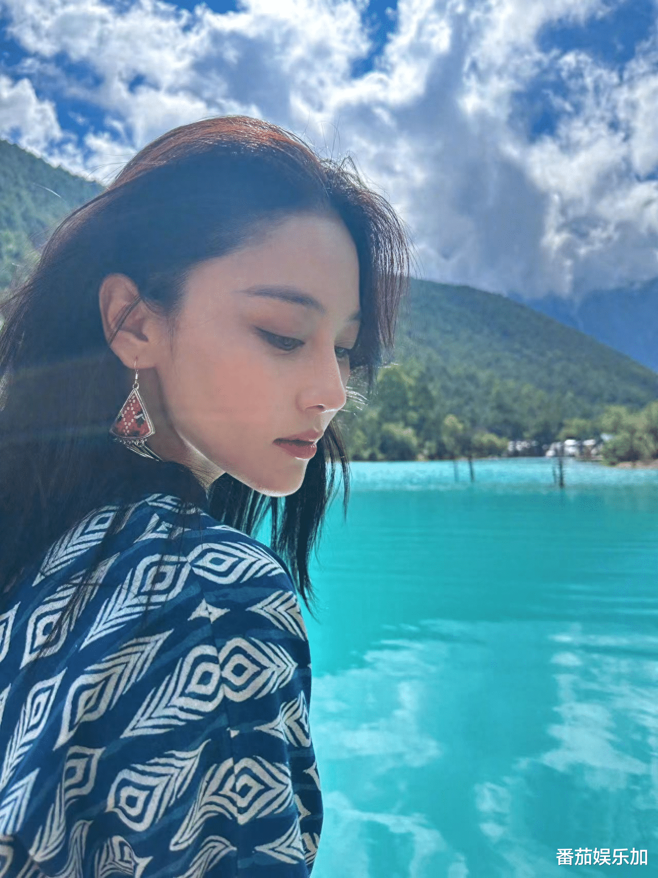 知名“军嫂”演员张馨予满脸扎针太渗人,评论区沦陷