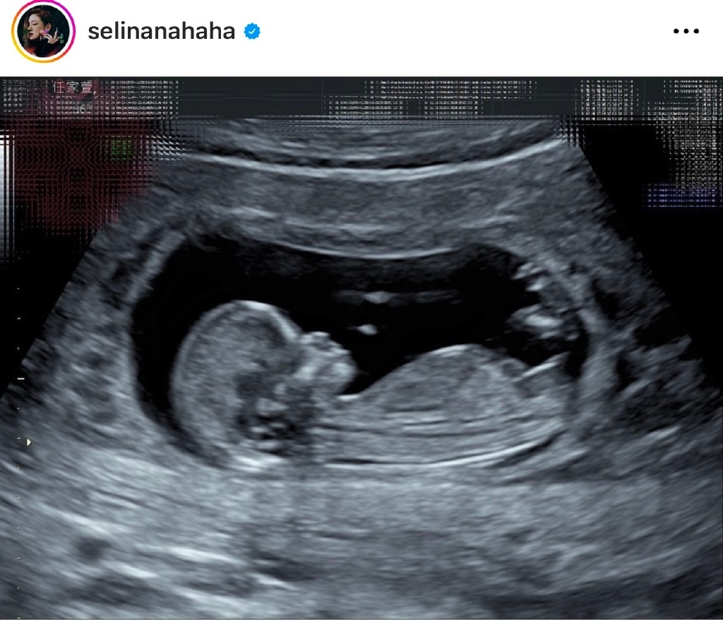 Selina|任家萱和闺蜜聚餐,素颜出镜真实颜值曝光,还曝“小腰果”的现况