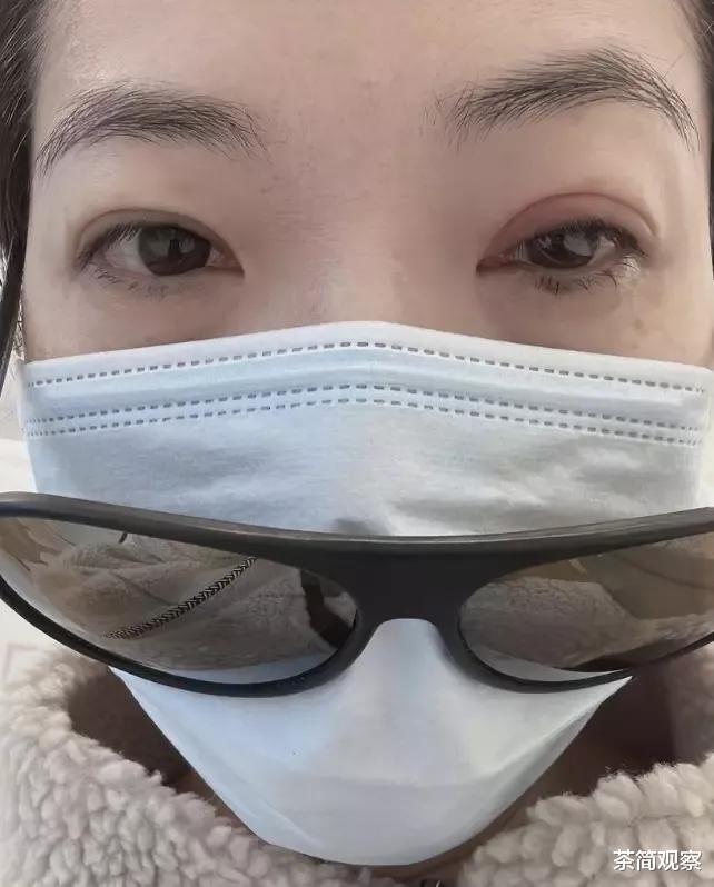 车婉婉|突发!陈小春前女友疑被家暴,曾多次晒自己与6岁儿子面部受伤照