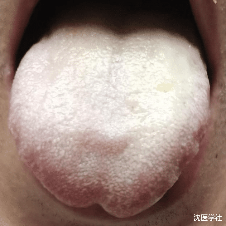 失眠在痰，手脚麻木在痰，小腹肥胖还在痰！一个药，横扫一身痰湿