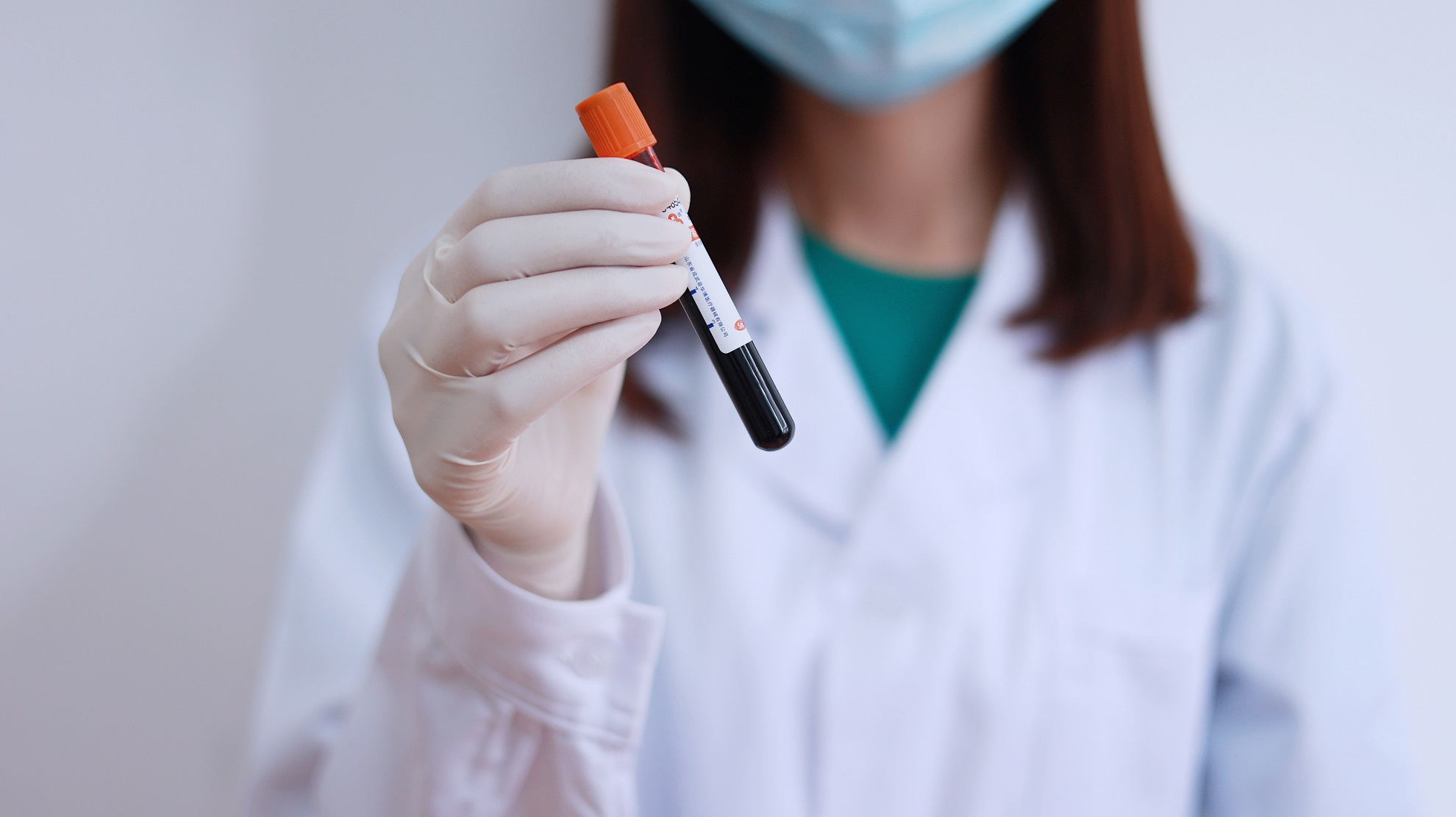 高脂血症患者应该怎样吃才健康？你吃对了吗？