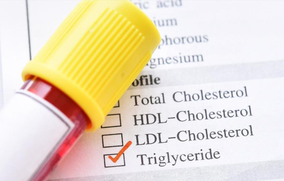 血脂高的人能不能吃肉？提醒：想避免血管堵塞，吃肉遵循5个原则