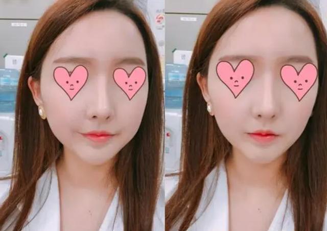 “套路太深了”！女大学生入职却被怂恿整容，公司却一问三不知