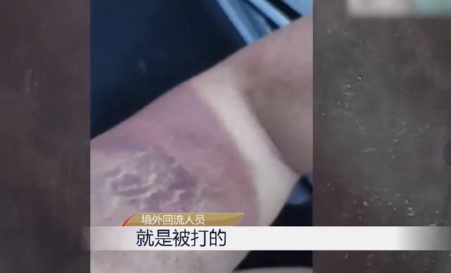 记者卧底缅甸“黑产”,有些人不值得同情!你救不活寻死的人!