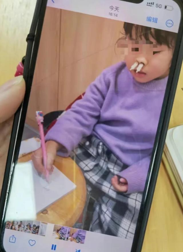 “儿科主任”治鼻炎：家长花费上万元，22名孩子鼻腔糜烂似烧伤