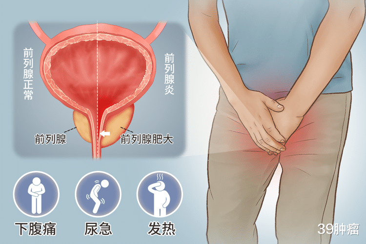 男人这4个行为，会“伤害”到前列腺，头一个很多人都在做