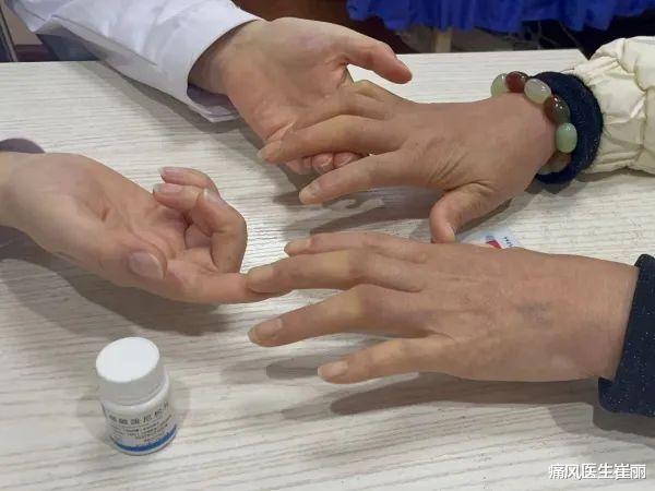 为什么不建议类风湿自己买药吃?