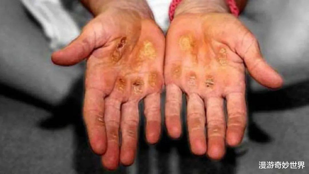 一组你没见过的震撼照片,告诉你职业运动员有恐怖……