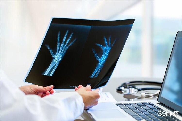 财富多少，看指纹便知？中科院解开“斗”和“簸箕”的基因真相