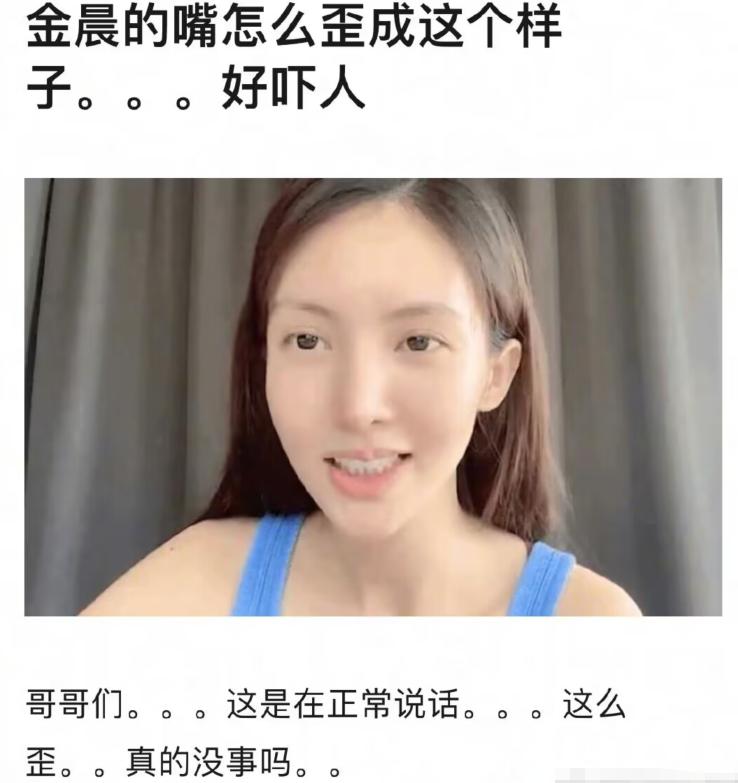 金晨加盟《庆余年2》遭疯狂吐槽抢角色,嘴歪科技脸明显,不合适