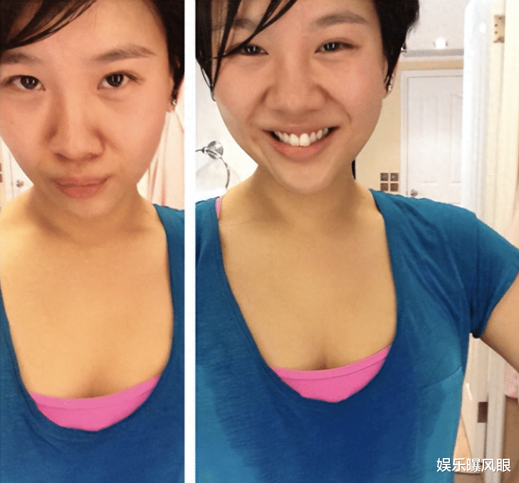 郑欣宜抑郁失踪后晒自拍!瘦到90斤腋下汗湿,剪短长发引人心疼