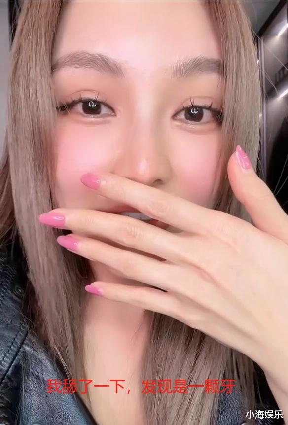 周扬青吃东西牙齿脱落,对镜头自拍超有喜感,自称说话直漏风