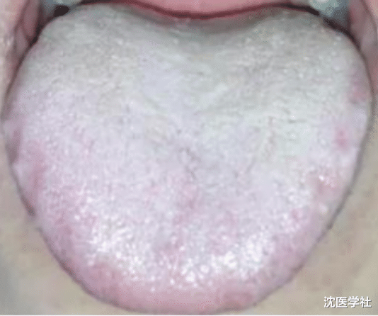 4个男科用药，胜过西地那非，让你肾足底气足，有效起萎不费劲