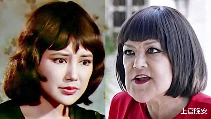 越整越难看后遗症一堆的9位女星!脸像鞋拔子,笑比哭难看