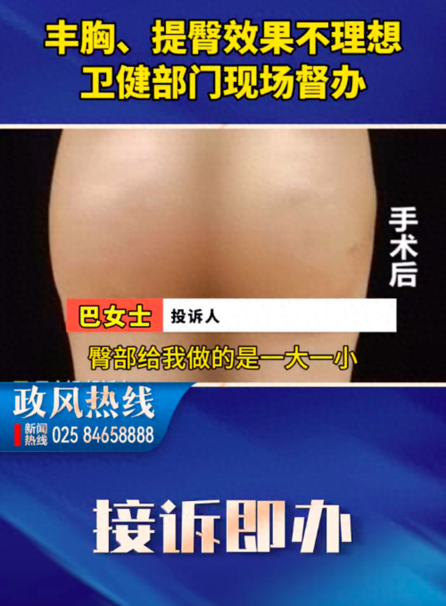 女子整形后臀部一大一小，“胸部也疼了一年，我花钱是为变美的，不是受罪的”，当地：存在操作不规范