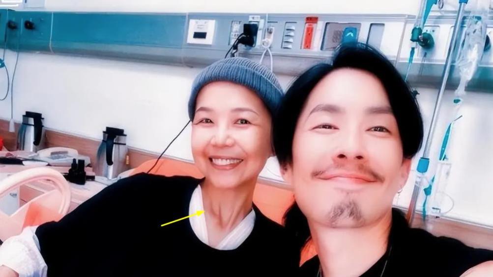 48岁知名导演陈慧翎去世！一月前还很乐观，生前化疗暴瘦到变形！