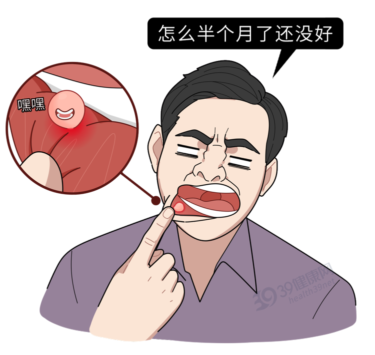 口腔溃疡|反复口腔溃疡是癌症前兆？提醒：开始癌变前，可能会有3种迹象