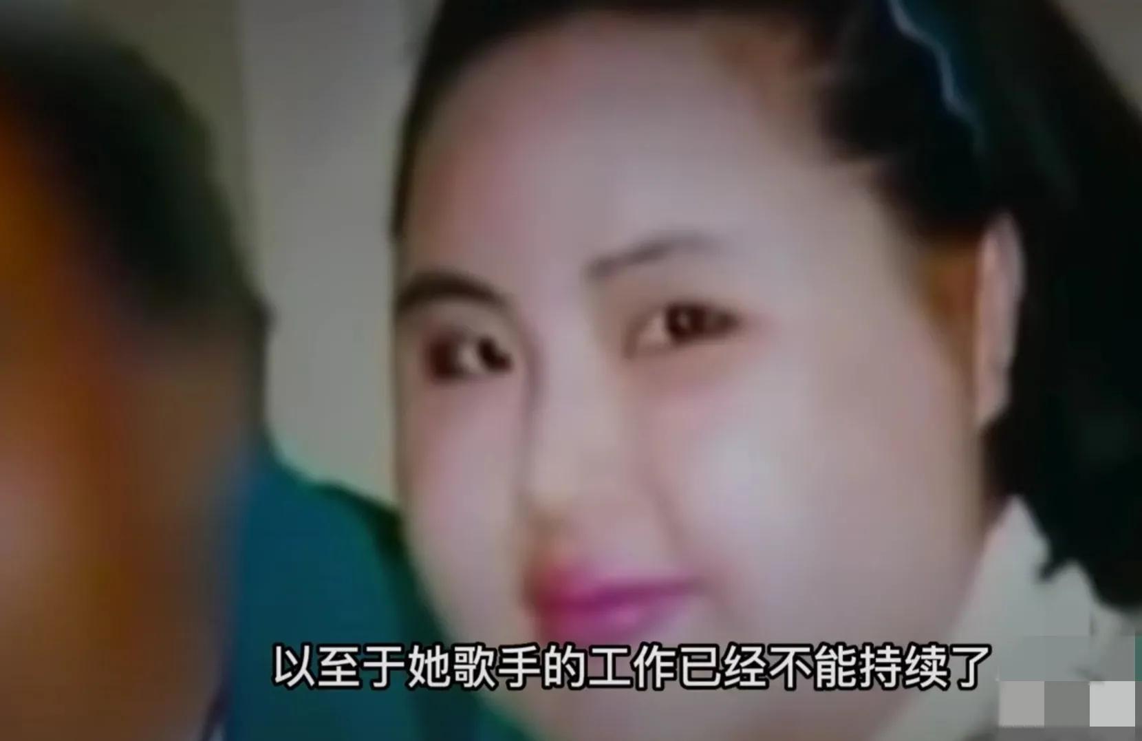 韩慧景|28岁女歌星整容成瘾!缺钱整容自己动手:脸上注射香油和水泥!