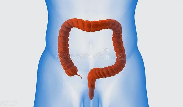 大蒜|为什么肠道容易长“息肉”?肠子如果有息肉,身体或有这5个表现