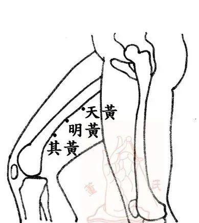非常好用的“减肥针法”