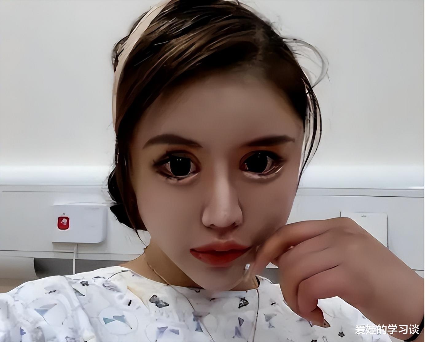 上海00后整容狂人:4年花600万“削骨”,如今模样大变还泪腺失控