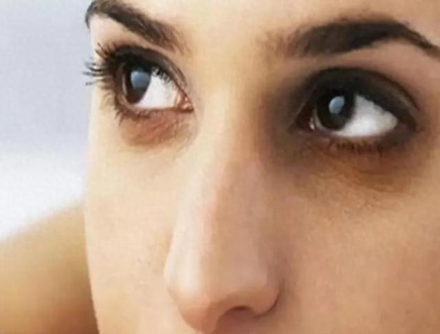 肝变硬，头先知？医生提醒：头部若出现这3种情况，建议重视起来