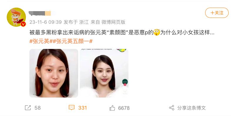 张元英素颜照曝光！整容痕迹超重，面部浮肿僵硬，瞬间老了20岁