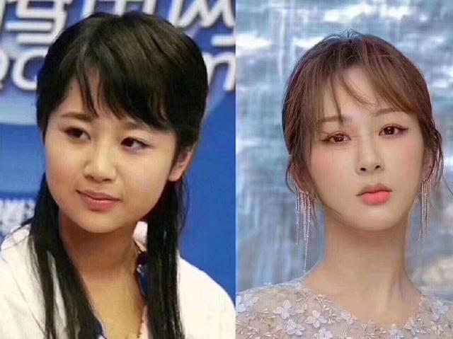 整容|长得“歪瓜裂枣”,整得“如花似玉”,这些女星都靠脸逆天改命
