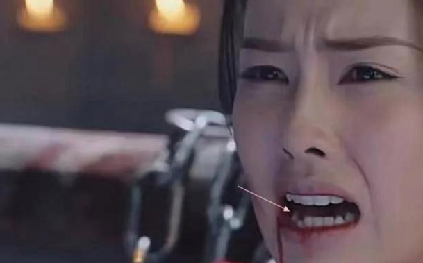 虎牙|半个娱乐圈都做牙，假牙成了潮流，“丑”的千奇百怪一笑就露馅